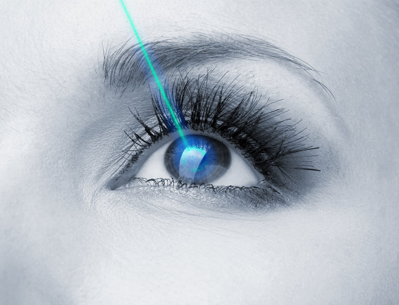 Selective Laser Trabeculoplasty : Vision Correction
